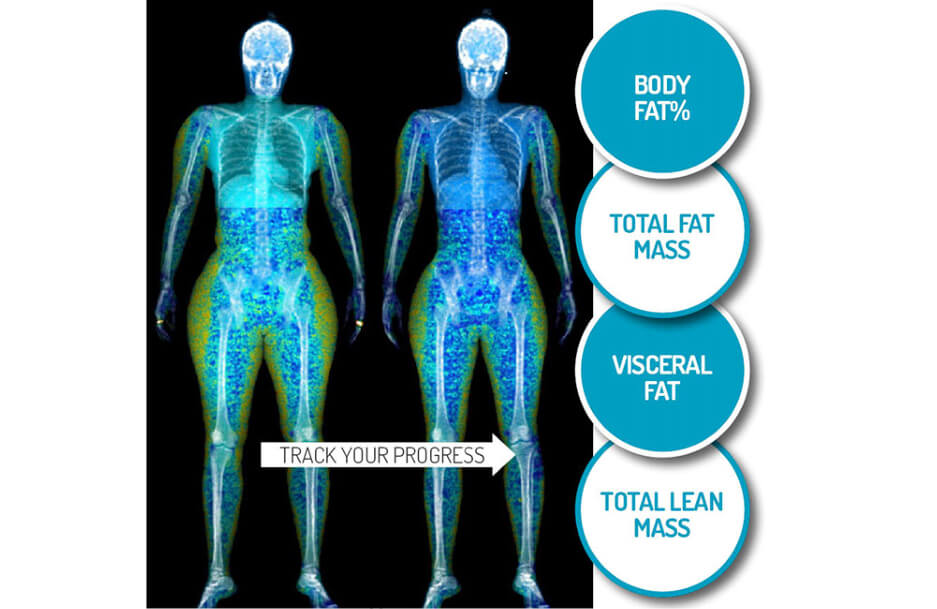 How a DEXA Body Fat, Muscle, and Bone Scan Can Help You Get Fit